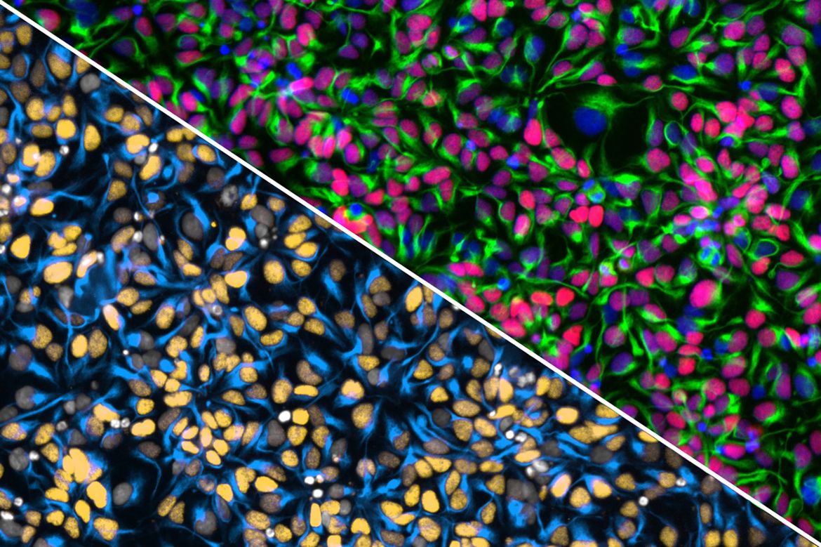 Human stem cell-derived neural progenitor cells grown together in a shared culture, forming a “cell village”.